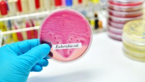 Έρευνα: 40 στα 100 κρέατα περιέχουν ανθεκτικό σε αντιβιοτικά E.Coli - Cibum.gr