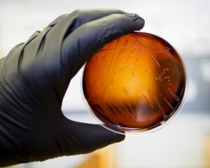 Νέο τρόπο ανίχνευσης της μόλυνσης από Listeria στα τρόφιμα και ένα εμβόλιο για τον  νοροϊό ανακαλύπτουν μεγάλα πανεπιστήμια - Cibum.gr