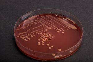 Ισραήλ: Salmonella σε σοκολάτα στέλνει δύο παιδιά και έναν 27χρονο στο νοσοκομείο – Επικρίσεις κατά του Υπουργείου Υγείας