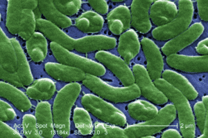Vibrio vulnifucis: Γιατί ανακαλούνται τα τρόφιμα στα οποία ανιχνεύεται