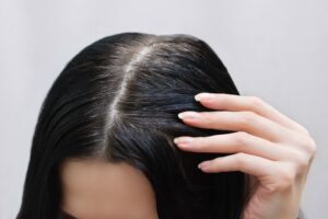 Αυτό το τρόφιμο μεγαλώνει μαλλιά και νύχια