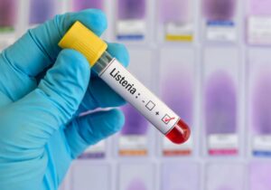 Listeria monocytogenes: Δεν έχουν όλα τα τρόφιμα τον ίδιο κίνδυνο – Το πρόβλημα της “μηδενικής ανοχής”