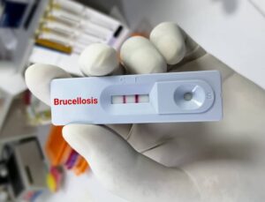 Νέα μελέτη δείχνει πώς η βρουκέλλωση επηρεάζει τον εγκέφαλο