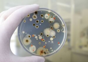 Πως επηρέασαν τα μέτρα για τον COVID-19 τα τροφιμογενή παθογόνα