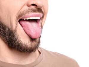 Τι χρώμα έχει η γλώσσα σας; Πότε πρέπει να πάτε στο γιατρό
