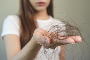 Ποια τρόφιμα προκαλούν τριχόπτωση και ποια την αποτρέπουν