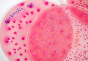 Τι είναι το E. coli που παράγει τις θανατηφόρες τοξίνες Shiga