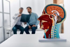 Οι αιτίες πίσω από την αύξηση των εγκεφαλικών παγκοσμίως