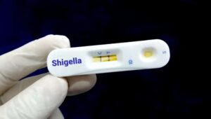 Καλιφόρνια: Λοίμωξη από Shigella για 8 άτομα που παρευρέθηκαν σε δείπνο