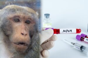 Ο Ευρωπαϊκός Οργανισμός φαρμάκων συνιστά την επέκταση του εμβολίου κατά της ιλαράς mpox στους εφήβους