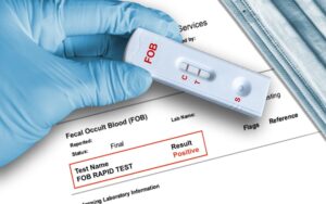 Διευκρινίσεις για τα self test από το υπουργείο Υγείας: “Δεν ανιχνεύουν αν κάποιος έχει καρκίνο στο παχύ έντερο”