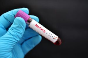 Τι είναι ο ιός Μάρμπουργκ που εμφανίστηκε στη Γερμανία;