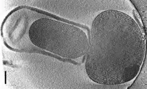 Πως το παθογόνο Listeria ξεγελάει τα τεστ ανίχνευσης – Ερευνητές αναπτύσσουν νέες μεθόδους
