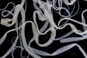 Επιδημία «ταινίας» σε Βελγικό σχολείο – Πατέρας τράβηξε από το σώμα του γιου του σκουλήκι μήκους 1 μέτρου