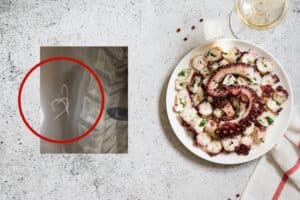 Στο νοσοκομείο 38χρονος από το Αγρίνιο – Κατάπιε αγκίστρι που ήταν μέσα σε χταπόδι