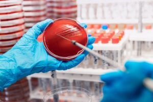 Βιομηχανία Τροφίμων: Γιατί είναι σημαντική η ακριβής αναγνώριση μικροβίων