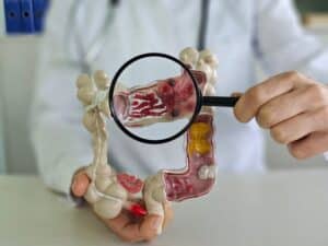 Τεχνητή νοημοσύνη προβλέπει με 80% ακρίβεια αν ένας καρκίνος θα μεταστατίσει