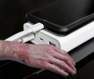 Γιατί ανακαλούνται εκατομμύρια Power Banks – Νέος πανικός για πυρκαγιές – Ανακαλούνται 55.380 φορτιστές