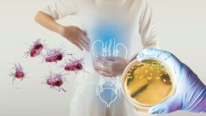 E. coli: Η μόλυνση που μπορεί να «χτυπήσει» τα νεφρά και μετά από 10 χρόνια
