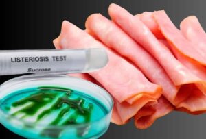 Αυτά είναι τα τρόφιμα που ευθύνονται περισσότερο για λιστερίωση