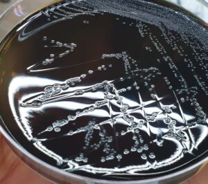 Γιατί η Listeria είναι περισσότερο επικίνδυνη στο σολομό παρά στο λουκάνικο; Ευρήματα μελέτης