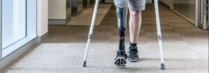 Σοβαρός τραυματισμός εργαζόμενου σε εταιρεία χονδρικής τροφίμων που οδήγησε σε ακρωτηριασμό  