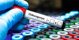 Αύξηση κρουσμάτων Chikungunya σε ταξιδιώτες που επιστρέφουν από Σεϋχέλλες