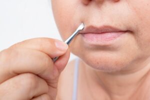 Υπερβολική τριχοφυΐα στο πρόσωπο; Αυτές οι 7 αλλαγές στη διατροφή μπορούν να βοηθήσουν