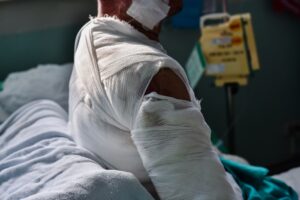 Δέκαχρονος μαθητής με σοβαρά εγκαύματα από φωτιά σε εστιατόριο