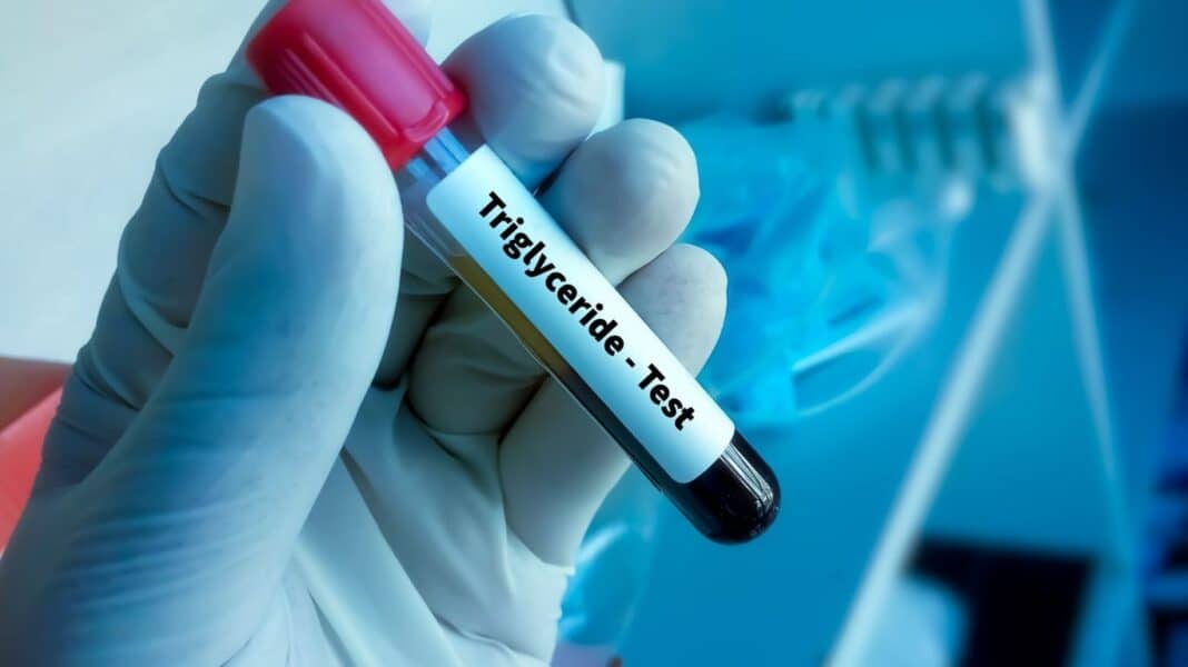 Τέσσερις βραδινές συνήθειες που αυξάνουν τα τριγλυκερίδια