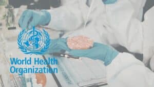 Παράσιτα στα τρόφιμα: 171 εκατ. λοιμώξεις και 33.800 θάνατοι παγκοσμίως το 2021 σύμφωνα με τον ΠΟΥ