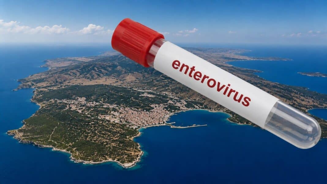 Η άγνωστη επιδημία εντεροϊού στη Λέσβο: Η μεγαλύτερη συρροή άσηπτης μηνιγγίτιδας των τελευταίων ετών